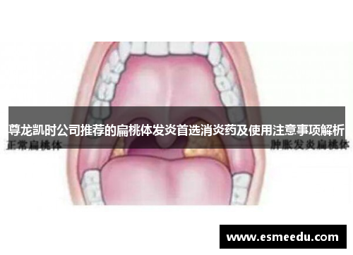 尊龙凯时公司推荐的扁桃体发炎首选消炎药及使用注意事项解析